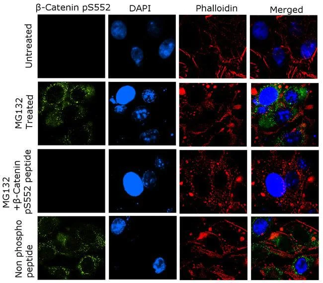 Immunocytochemistry/ Immunofluorescence - Anti-beta Catenin (phospho S552) antibody [1HCLC] (AB277785)