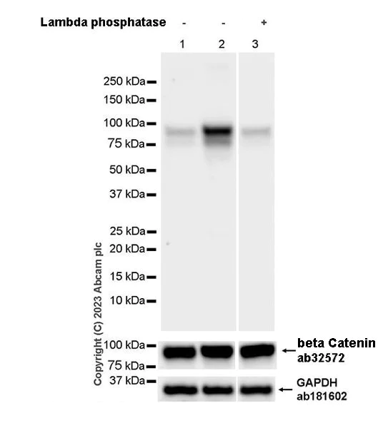 Western blot - Anti-beta Catenin (phospho S552) antibody [EPR28411-7] - BSA and Azide free (AB314503)