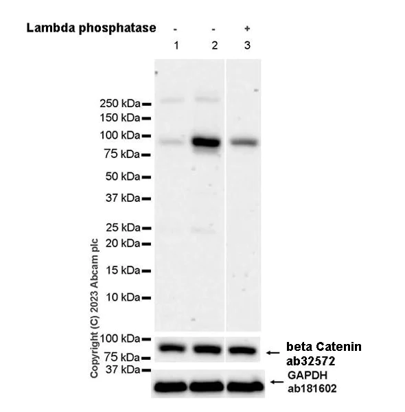 Western blot - Anti-beta Catenin (phospho S552) antibody [EPR28411-7] - BSA and Azide free (AB314503)