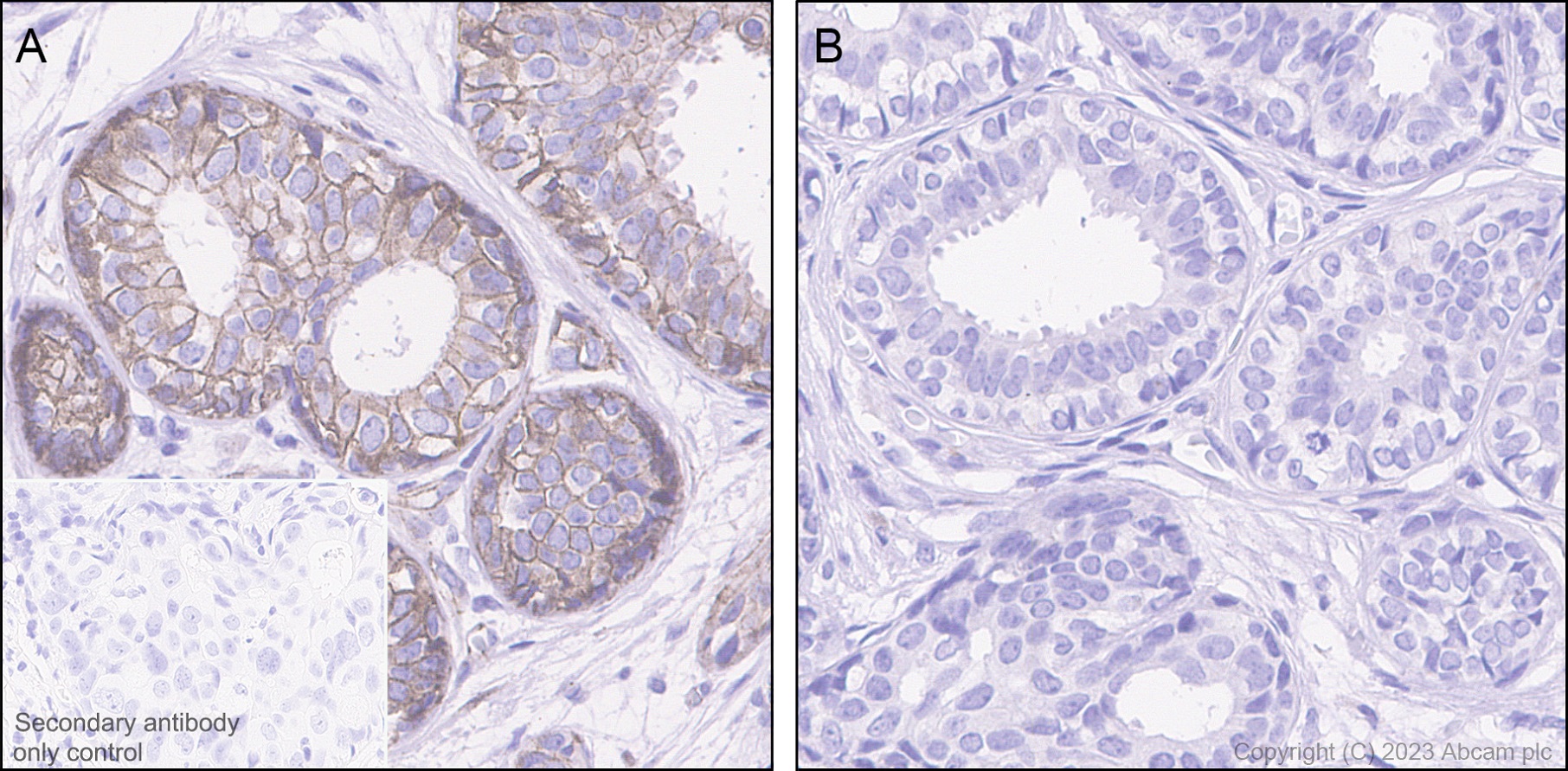 Immunohistochemistry (Formalin/PFA-fixed paraffin-embedded sections) - Anti-beta Catenin (phospho S675) antibody [EPR28410-45] (AB314450)