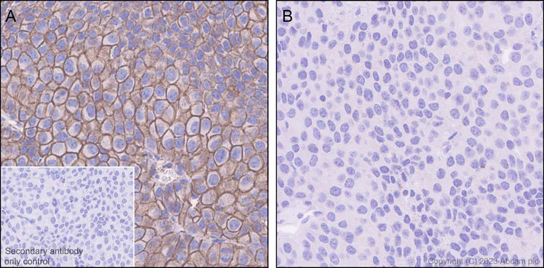 Immunohistochemistry (Formalin/PFA-fixed paraffin-embedded sections) - Anti-beta Catenin (phospho S675) antibody [EPR28410-45] (AB314450)