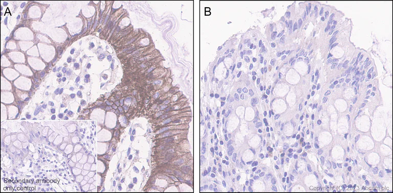 Immunohistochemistry (Formalin/PFA-fixed paraffin-embedded sections) - Anti-beta Catenin (phospho S675) antibody [EPR28410-45] - BSA and Azide free (AB314451)