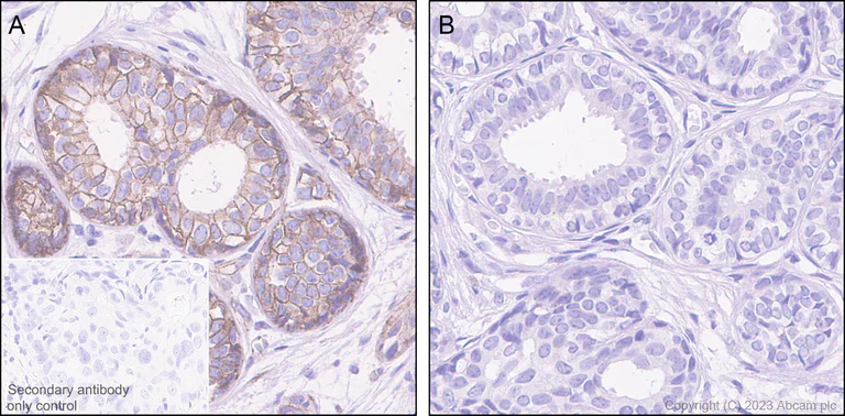 Immunohistochemistry (Formalin/PFA-fixed paraffin-embedded sections) - Anti-beta Catenin (phospho S675) antibody [EPR28410-45] - BSA and Azide free (AB314451)
