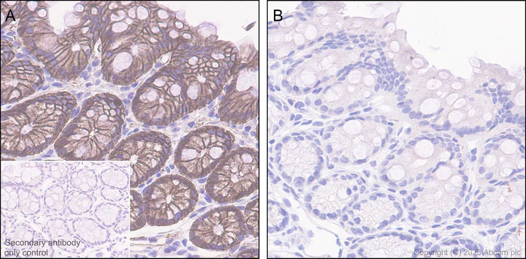 Immunohistochemistry (Formalin/PFA-fixed paraffin-embedded sections) - Anti-beta Catenin (phospho S675) antibody [EPR28410-45] - BSA and Azide free (AB314451)