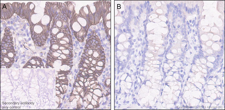 Immunohistochemistry (Formalin/PFA-fixed paraffin-embedded sections) - Anti-beta Catenin (phospho S675) antibody [EPR28410-45] - BSA and Azide free (AB314451)