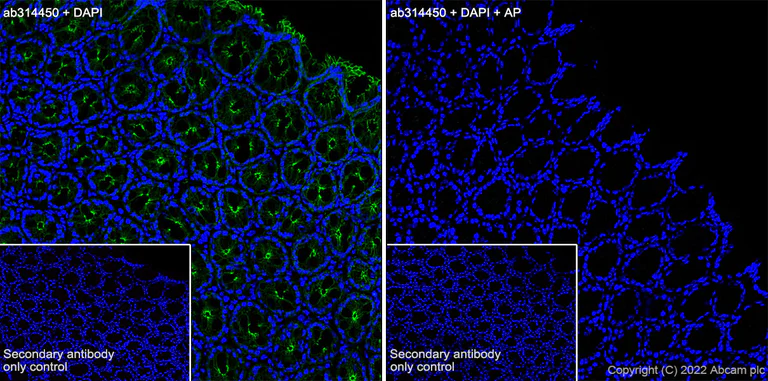 Immunohistochemistry (Frozen sections) - Anti-beta Catenin (phospho S675) antibody [EPR28410-45] - BSA and Azide free (AB314451)
