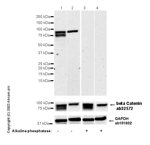 Western blot - Anti-beta Catenin (phospho S675) antibody [EPR28410-45] - BSA and Azide free (AB314451)