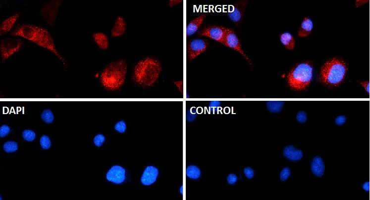 Immunocytochemistry/ Immunofluorescence - Anti-beta Catenin (phospho S675) antibody [SR4351] (AB326677)