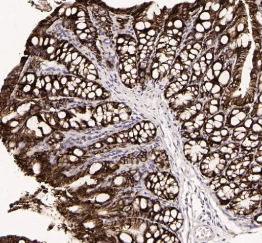 Immunohistochemistry (Formalin/PFA-fixed paraffin-embedded sections) - Anti-beta Catenin (phospho S675) antibody [SR4351] (AB326677)