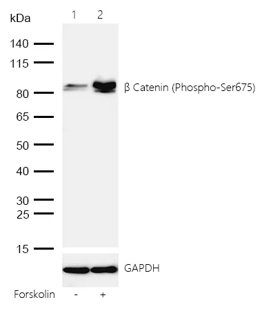 Western blot - Anti-beta Catenin (phospho S675) antibody [SR4351] (AB326677)