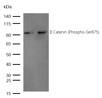 Western blot - Anti-beta Catenin (phospho S675) antibody [SR4351] (AB326677)