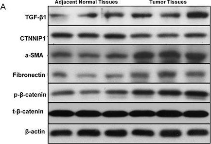 Western blot - Anti-beta Catenin (phospho T41 + S45) antibody [EP1905Y] (AB81305)