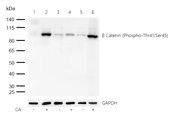 Western blot - Anti-beta Catenin (phospho T41 + S45) antibody [SR4352] (AB326678)