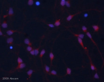 Immunocytochemistry/ Immunofluorescence - Anti-beta Catenin (phospho Y142) antibody (AB27798), expandable thumbnail