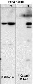 Western blot - Anti-beta Catenin (phospho Y142) antibody (AB27798)