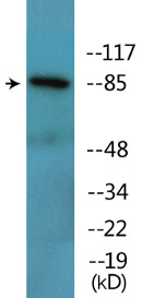 Western blot - Anti-beta Catenin (phospho Y489) antibody (AB138378)