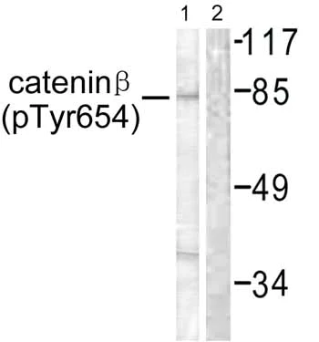 Western blot - Anti-beta Catenin (phospho Y654) antibody (AB59430)