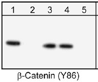 Western blot - Anti-beta Catenin (phospho Y86) antibody (AB29036)