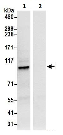 Immunoprecipitation - Anti-beta COP antibody (AB264352)