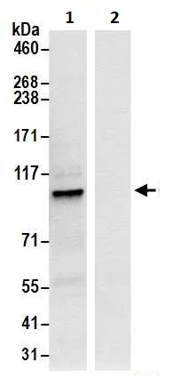 Immunoprecipitation - Anti-beta COP antibody (AB264352)