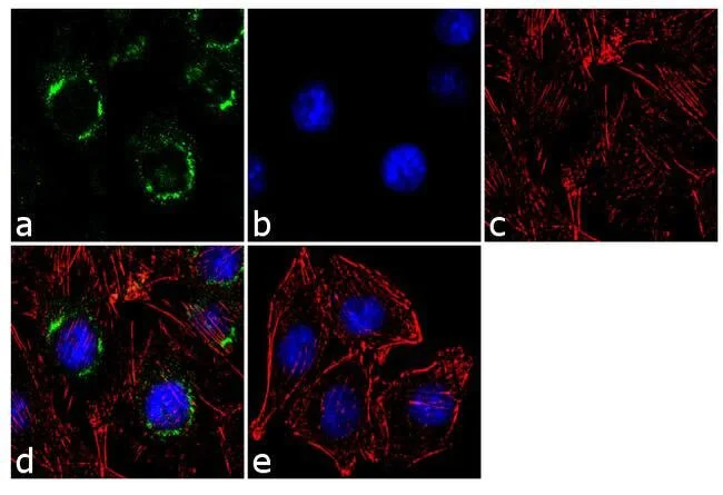 Immunocytochemistry/ Immunofluorescence - Anti-beta COP antibody (AB2899)