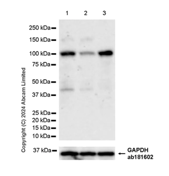 Western blot - Anti-beta COP antibody [EPR28895-55] (AB320729)