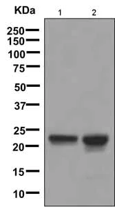 Western blot - Anti-beta Crystallin A3 antibody [EPR9585] (AB151713)