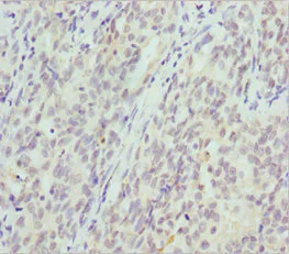 Immunohistochemistry (Formalin/PFA-fixed paraffin-embedded sections) - Anti-Beta crystallin S antibody (AB229949)