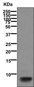 Western blot - Anti-beta Defensin 1 antibody [EPR6964(2)] (AB170962), expandable thumbnail