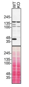 Western blot - Anti-beta Dystroglycan antibody (AB43125), expandable thumbnail