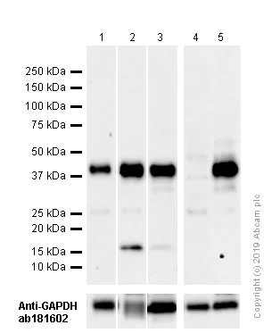 Western blot - Anti-beta Dystroglycan antibody [EP2200Y] (AB62373)