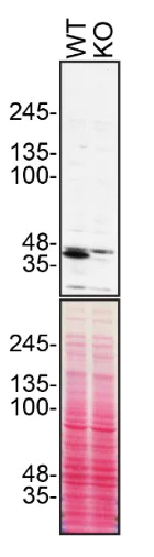 Western blot - Anti-beta Dystroglycan antibody [EP2200Y] (AB62373)