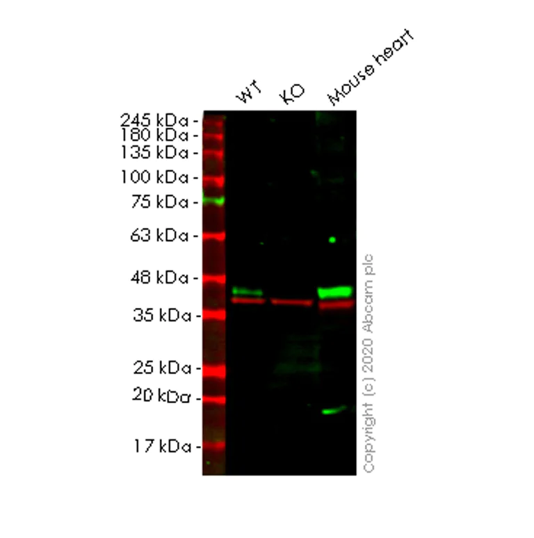 Western blot - Anti-beta Dystroglycan antibody [EP2200Y] (AB62373)