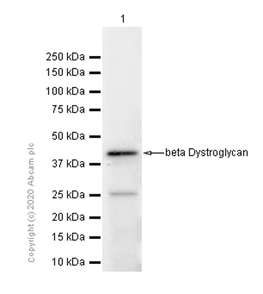 Western blot - Anti-beta Dystroglycan antibody [EP2200Y] - BSA and Azide free (AB284707)