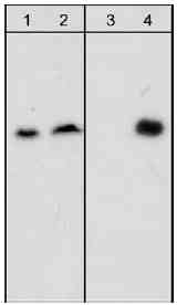 Western blot - Anti-beta Dystroglycan (phospho Y892) antibody [M117] (AB29037)
