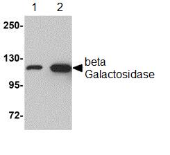 Western blot - Anti-beta Galactosidase antibody (AB106567)