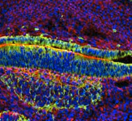 Immunohistochemistry (PFA perfusion fixed frozen sections) - Anti-beta Galactosidase antibody (AB134435)