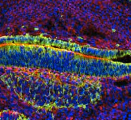 Immunohistochemistry (PFA perfusion fixed frozen sections) - Anti-beta Galactosidase antibody (AB134435)