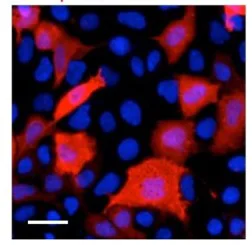 Immunocytochemistry/ Immunofluorescence - Anti-beta Galactosidase antibody (AB221199)