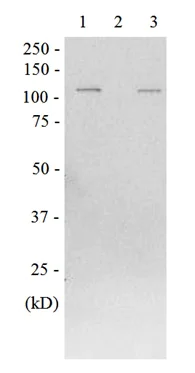 Western blot - Anti-beta Galactosidase antibody (AB221199)