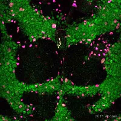 Immunocytochemistry/ Immunofluorescence - Anti-beta Galactosidase antibody (AB9361)
