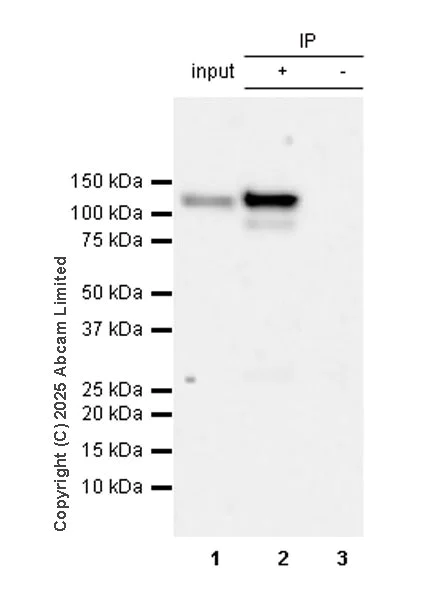 Immunoprecipitation - Anti-beta Galactosidase antibody [EPR29591-746] (AB324616)