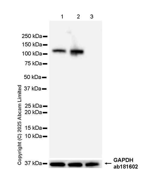 Western blot - Anti-beta Galactosidase antibody [EPR29591-746] (AB324616)