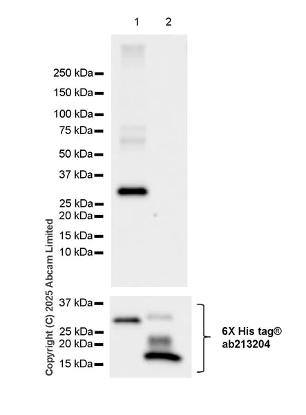 Western blot - Anti-beta Galactosidase antibody [EPR29591-746] (AB324616)
