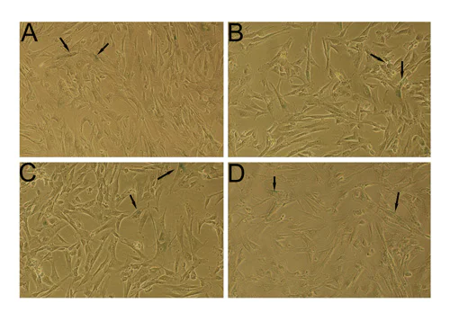 Immunohistochemistry (Frozen sections) - Beta Galactosidase Staining Kit (Senescence) (AB65351)