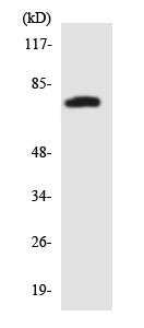 Western blot - Anti-beta glucuronidase (GUSB) antibody (AB136860), expandable thumbnail