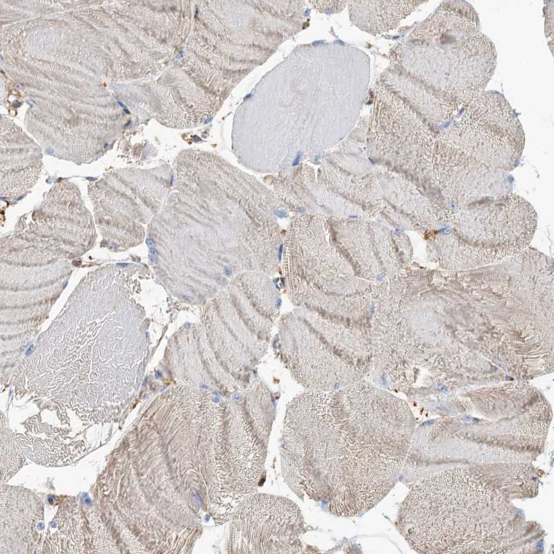 Immunohistochemistry (Formalin/PFA-fixed paraffin-embedded sections) - Anti-beta glucuronidase (GUSB) antibody (ab244453), expandable thumbnail