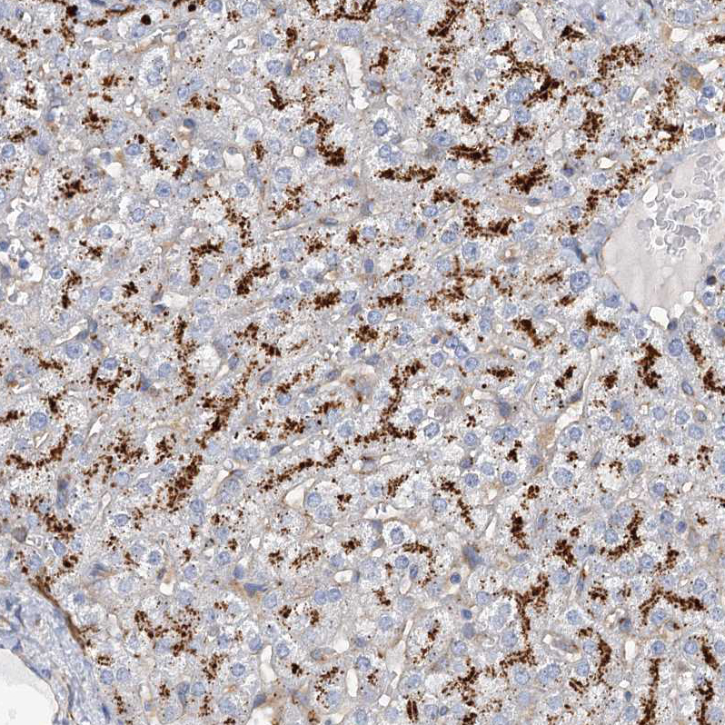 Immunohistochemistry (Formalin/PFA-fixed paraffin-embedded sections) - Anti-beta glucuronidase (GUSB) antibody (AB244453), expandable thumbnail
