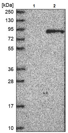 Western blot - Anti-beta glucuronidase (GUSB) antibody (AB244453), expandable thumbnail