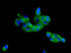 Immunocytochemistry/ Immunofluorescence - Anti-beta glucuronidase (GUSB) antibody [EPR10616] - BSA and Azide free (AB249385), expandable thumbnail